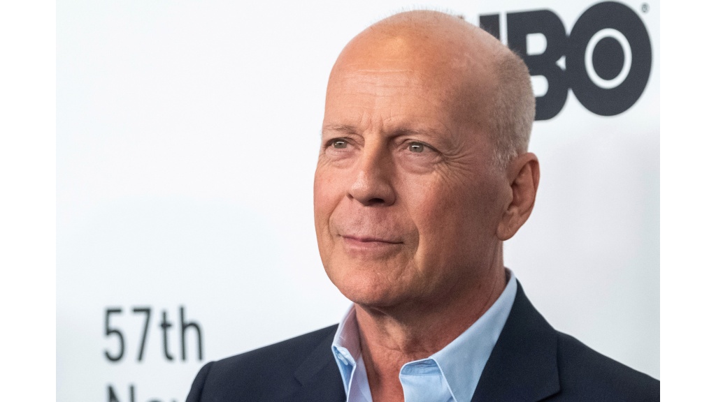 Bruce Willis has frontotemporal dementia. What is FTD?