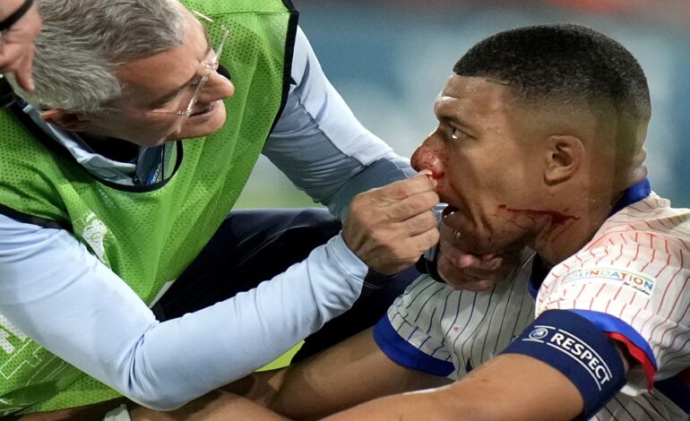 Kylian Mbappé may risk playing with broken nose at Euro 2024